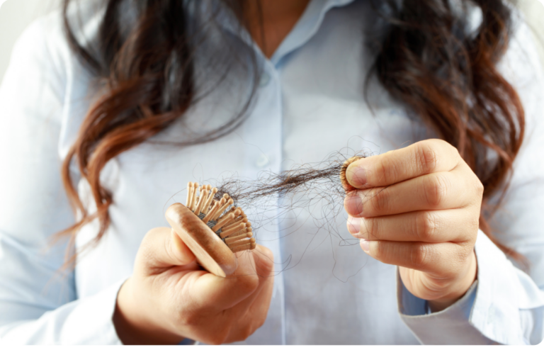 Close-up view of a woman holding a hairbrush filled with strands of hair, symbolizing hair loss.